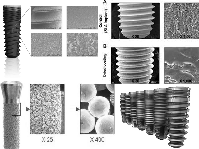 Implant Design