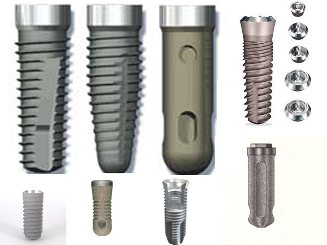 Implant Design