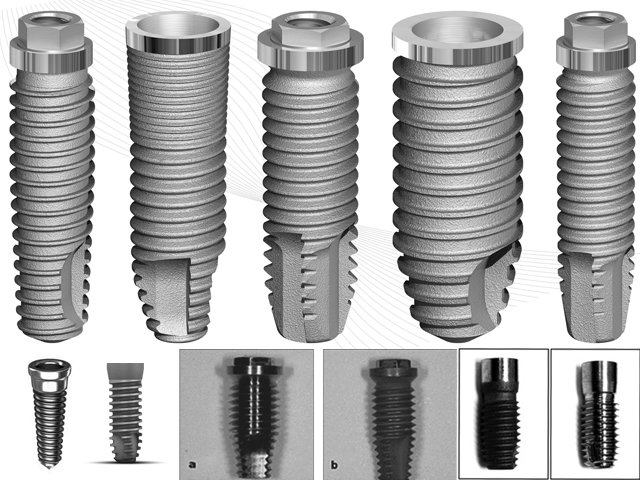 Implant Design