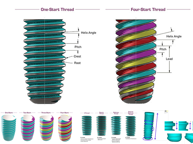 Implant Design